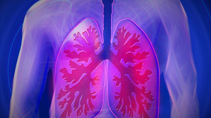 COPD lungs picture