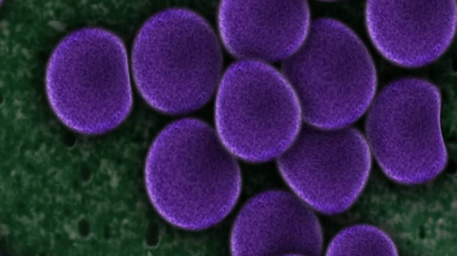 bad bacteria, colored purple