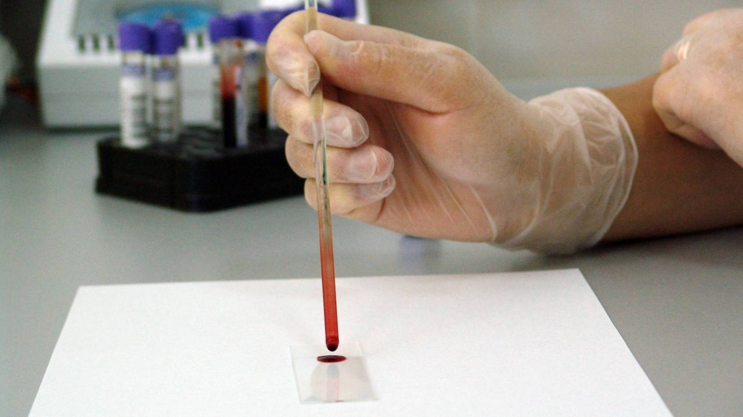 lab testing blood samples