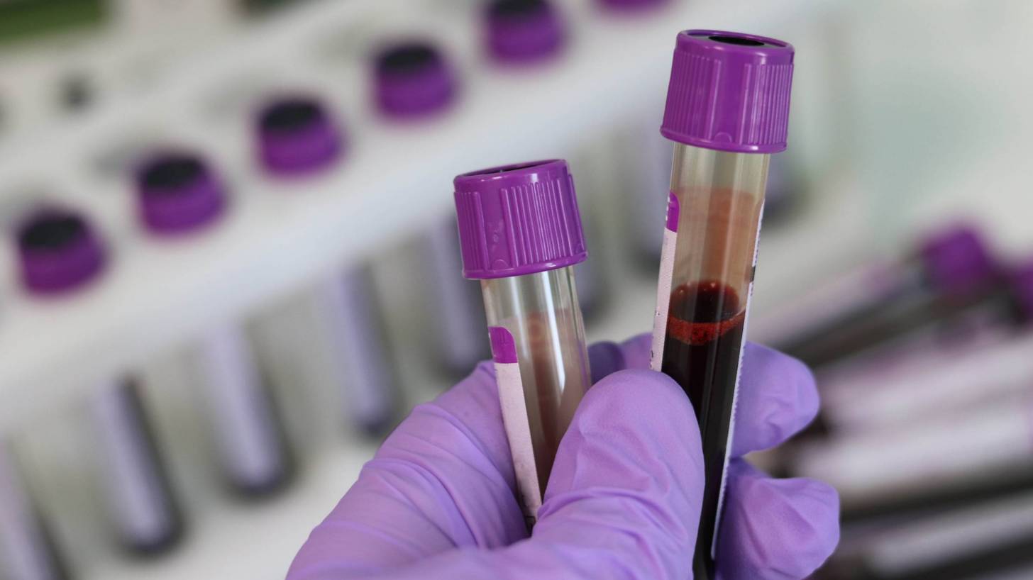 medical lab looking at blood vials