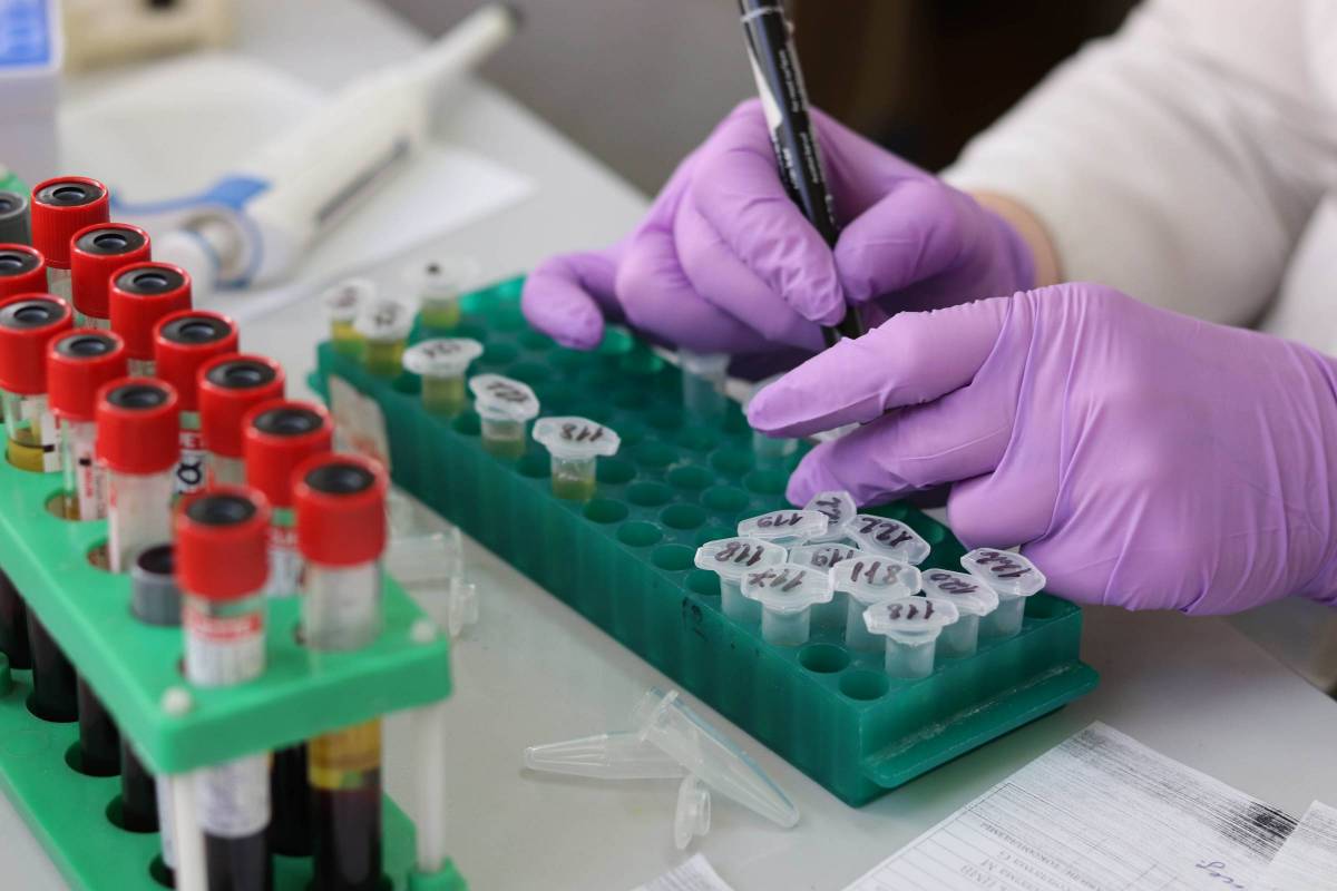 California Biotech Collaboration Explores Functional Chronic Hepatitis