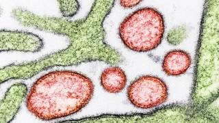 nipah virus under the microscope