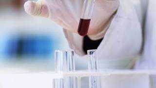 testing blood for HIV